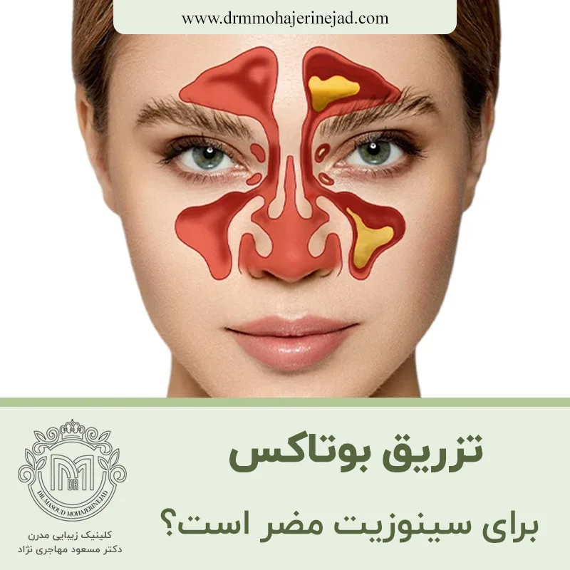 آیا بوتاکس برای سینوزیت مضر است؟