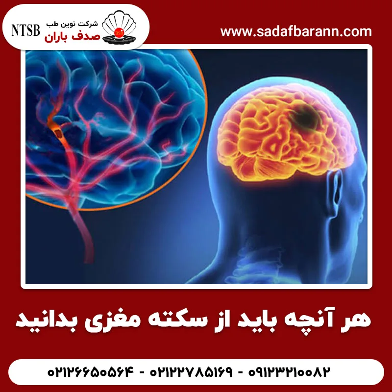 هر آنچه باید از سکته مغزی بدانید