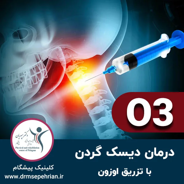 درمان دیسک گردن با تزریق اوزون