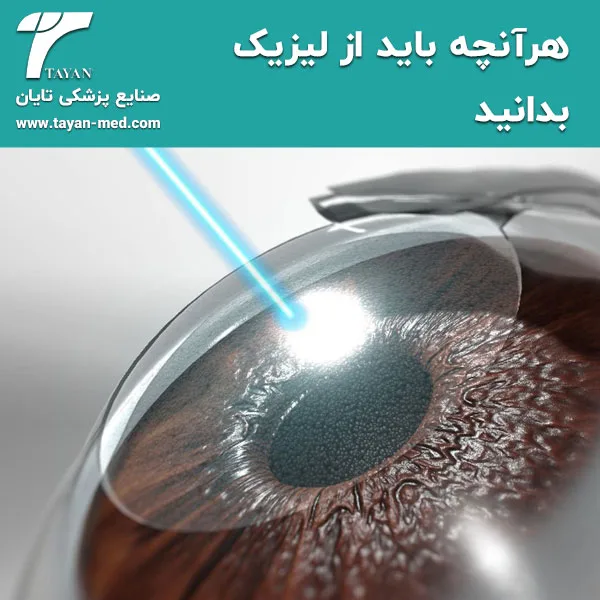 هر آنچه باید از لیزیک بدانید