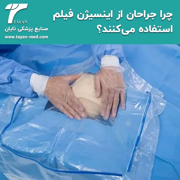 چرا جراحان از اینسیژن فیلم استفاده می‌کنند؟