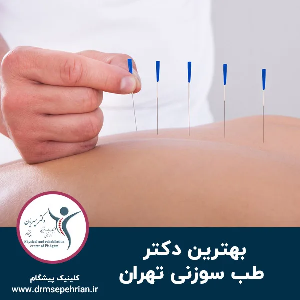 بهترین دکتر طب سوزنی تهران