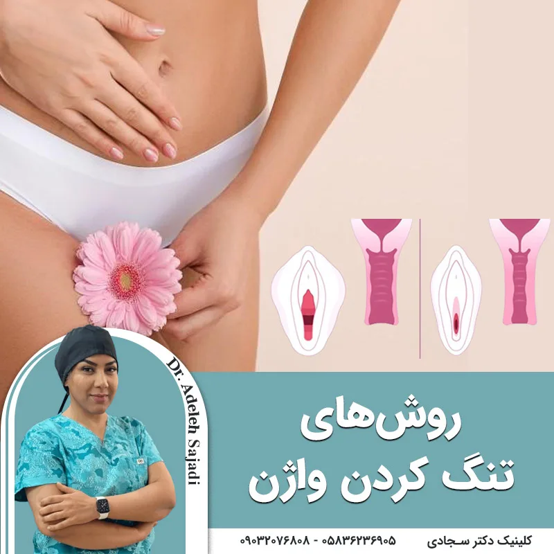 روش‌های تنگ کردن واژن