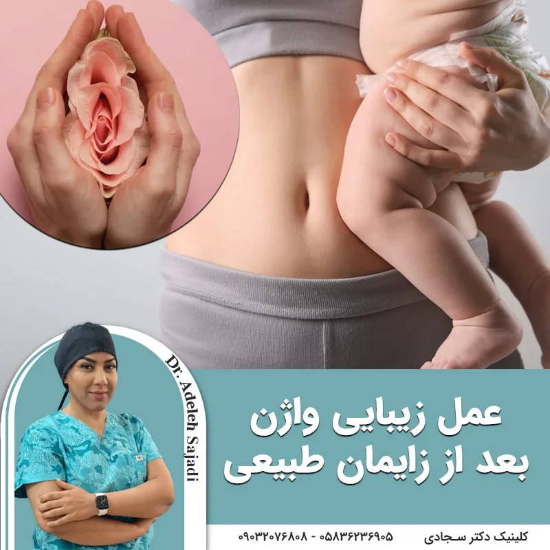 عمل زیبایی واژن بعد از زایمان طبیعی