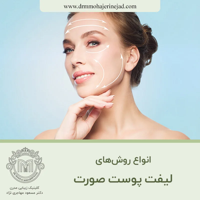 انواع روش‌های لیفت پوست صورت