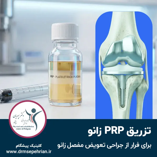 تزریق PRP زانو؛ راهکاری برای فرار از جراحی تعویض مفصل زانو