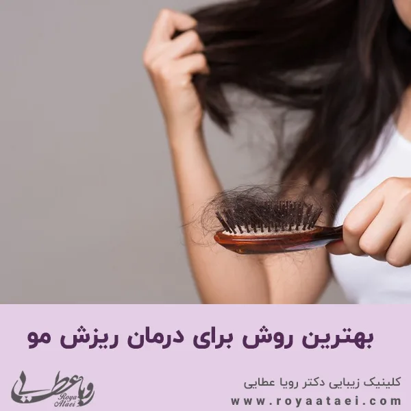 بهترین روش برای درمان ریزش مو