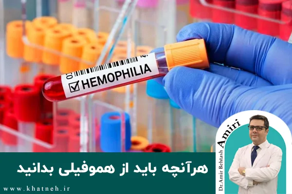 هرآنچه باید از هموفیلی بدانید