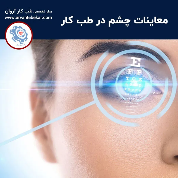 معاینات چشم در طب کار
