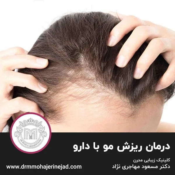 درمان ریزش مو با دارو
