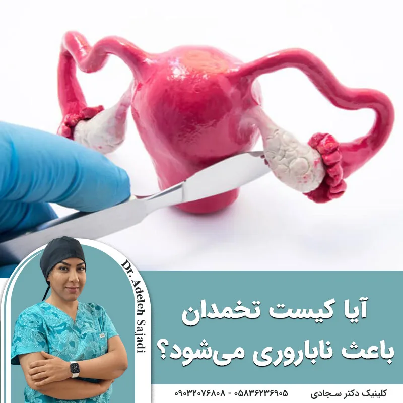 آیا کیست تخمدان باعث ناباروری می‌شود؟