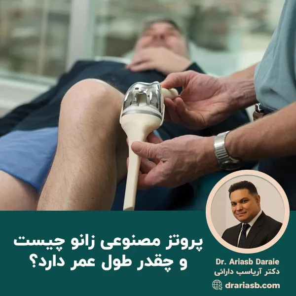 پروتز مصنوعی زانو چیست و چقدر طول عمر دارد؟