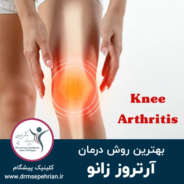 بهترین روش درمان آرتروز زانو چیست؟