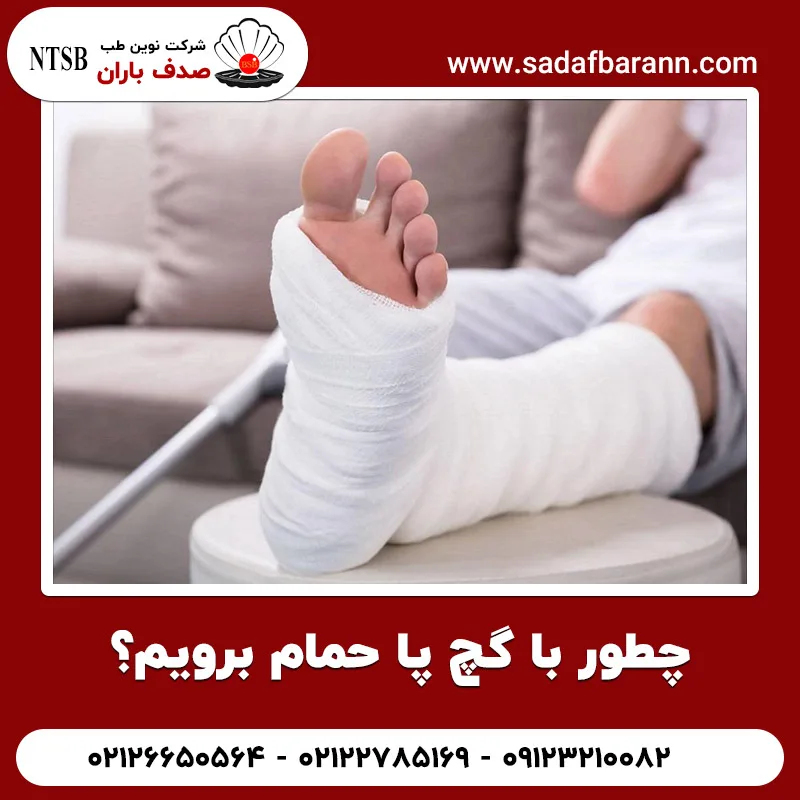 چطور با گچ پا حمام برویم؟