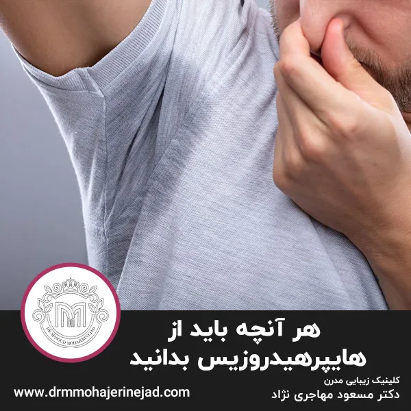 هر آنچه باید از هایپرهیدروزیس بدانید